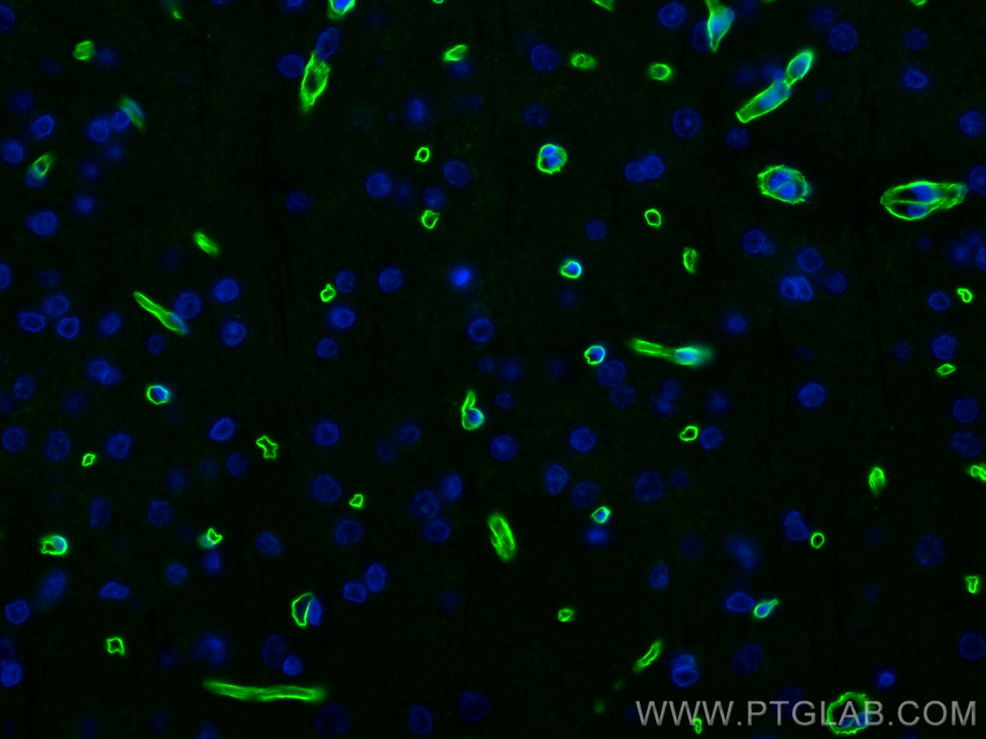 IF Staining of rat brain using 83609-6-RR (same clone as 83609-6-PBS)