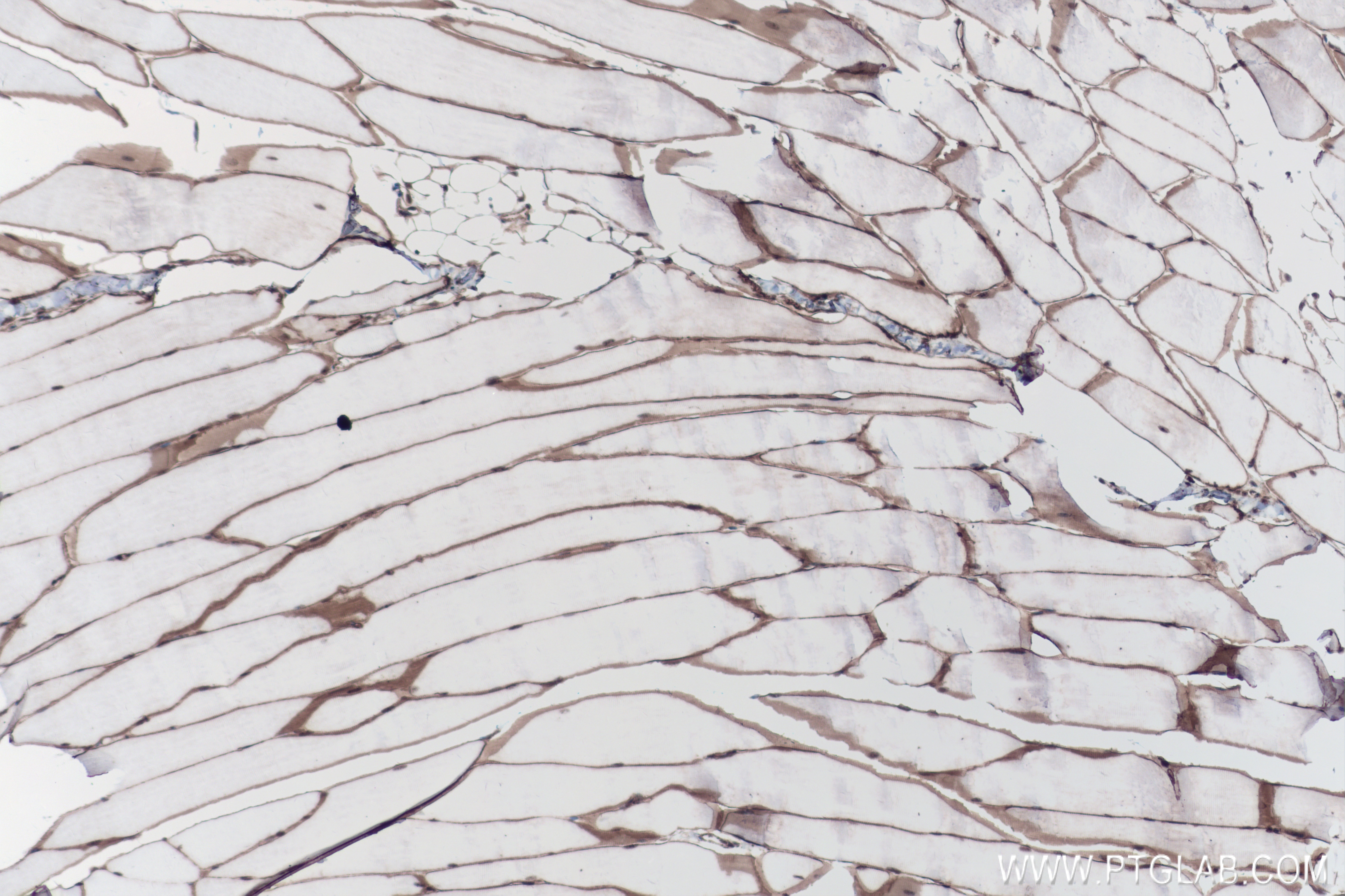 IHC staining of mouse skeletal muscle using 83609-6-RR (same clone as 83609-6-PBS)