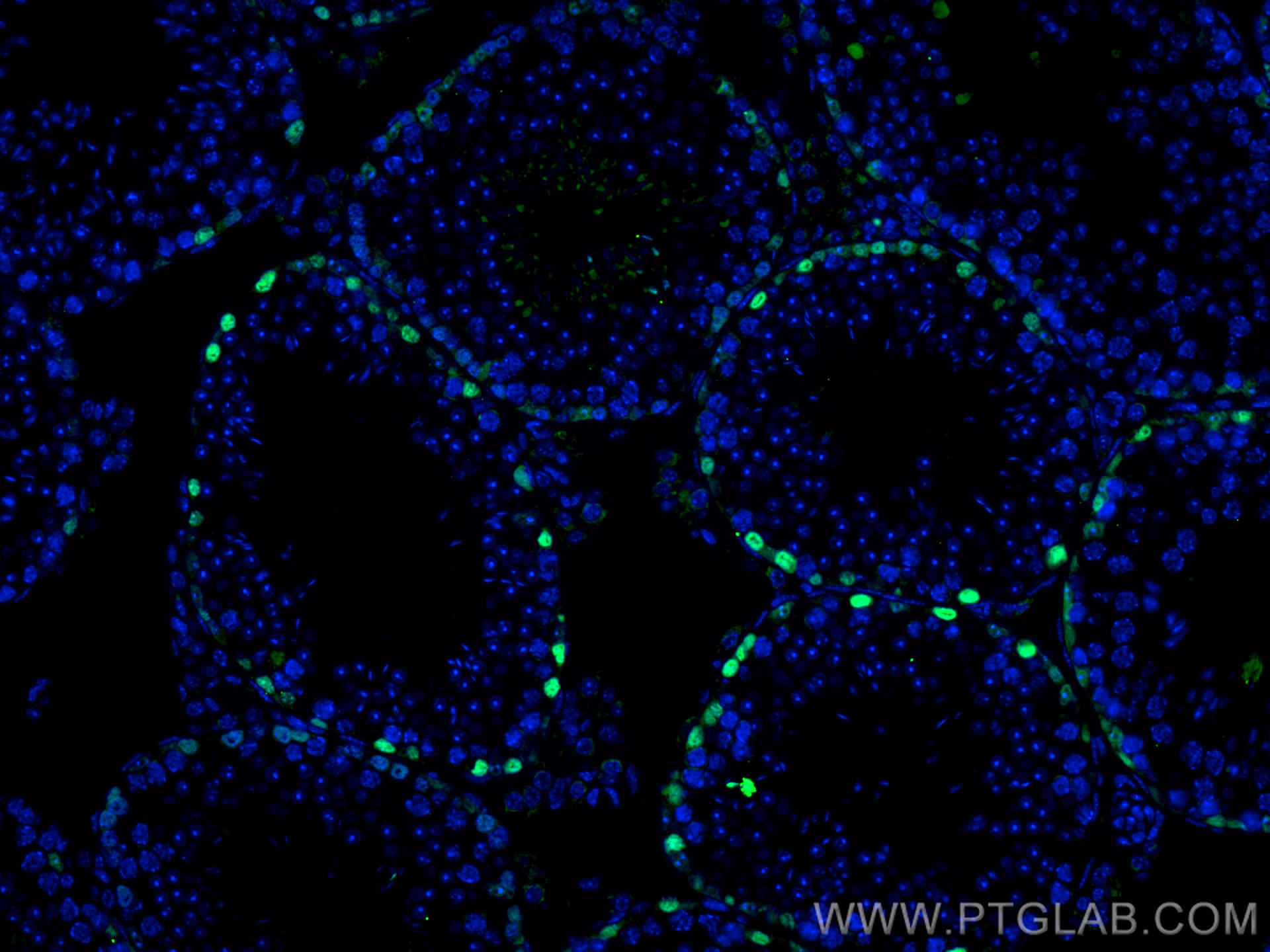 IF Staining of mouse testis using 14313-1-AP