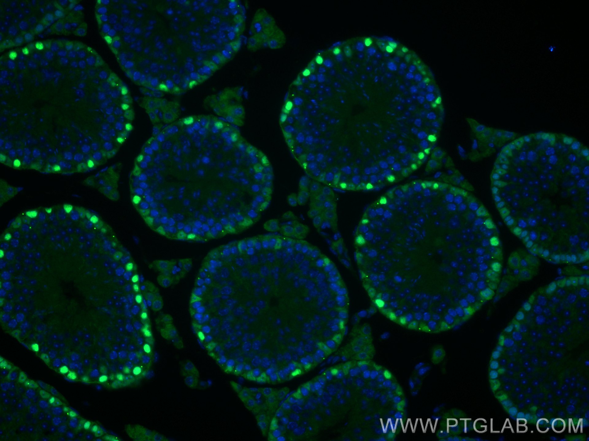 IF Staining of mouse testis using 28149-1-AP (same clone as 28149-1-PBS)