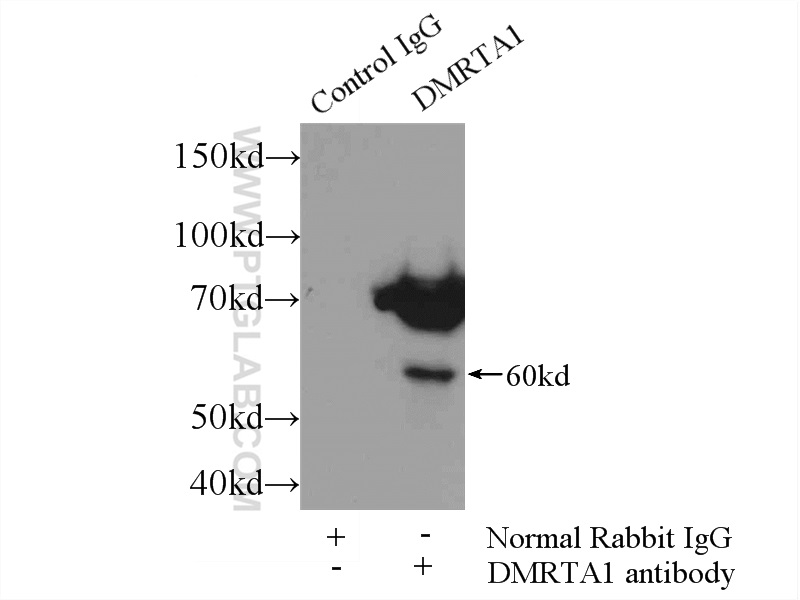 IP experiment of mouse liver using 24356-1-AP