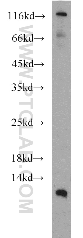 WB analysis of MCF-7 using 21473-1-AP