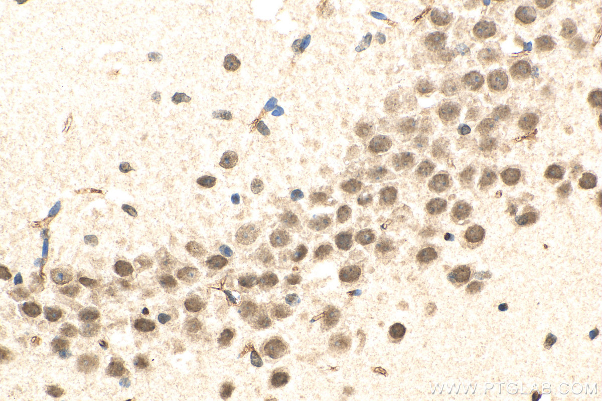 IHC staining of mouse brain using 16070-1-AP