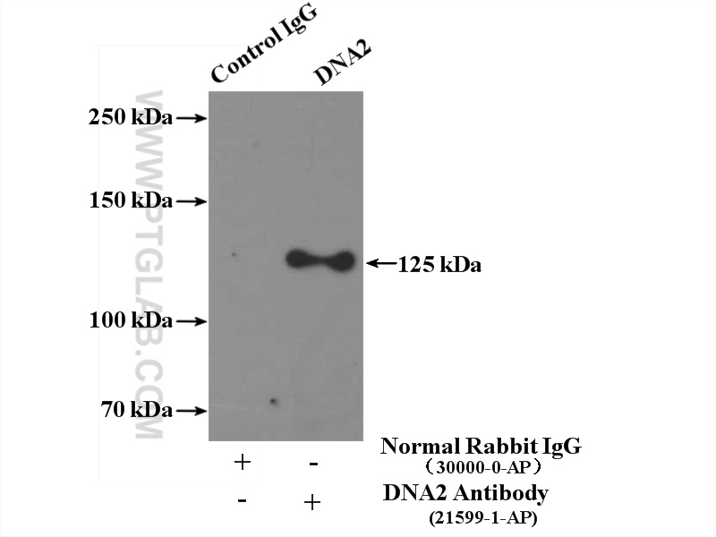 IP experiment of HEK-293 using 21599-1-AP