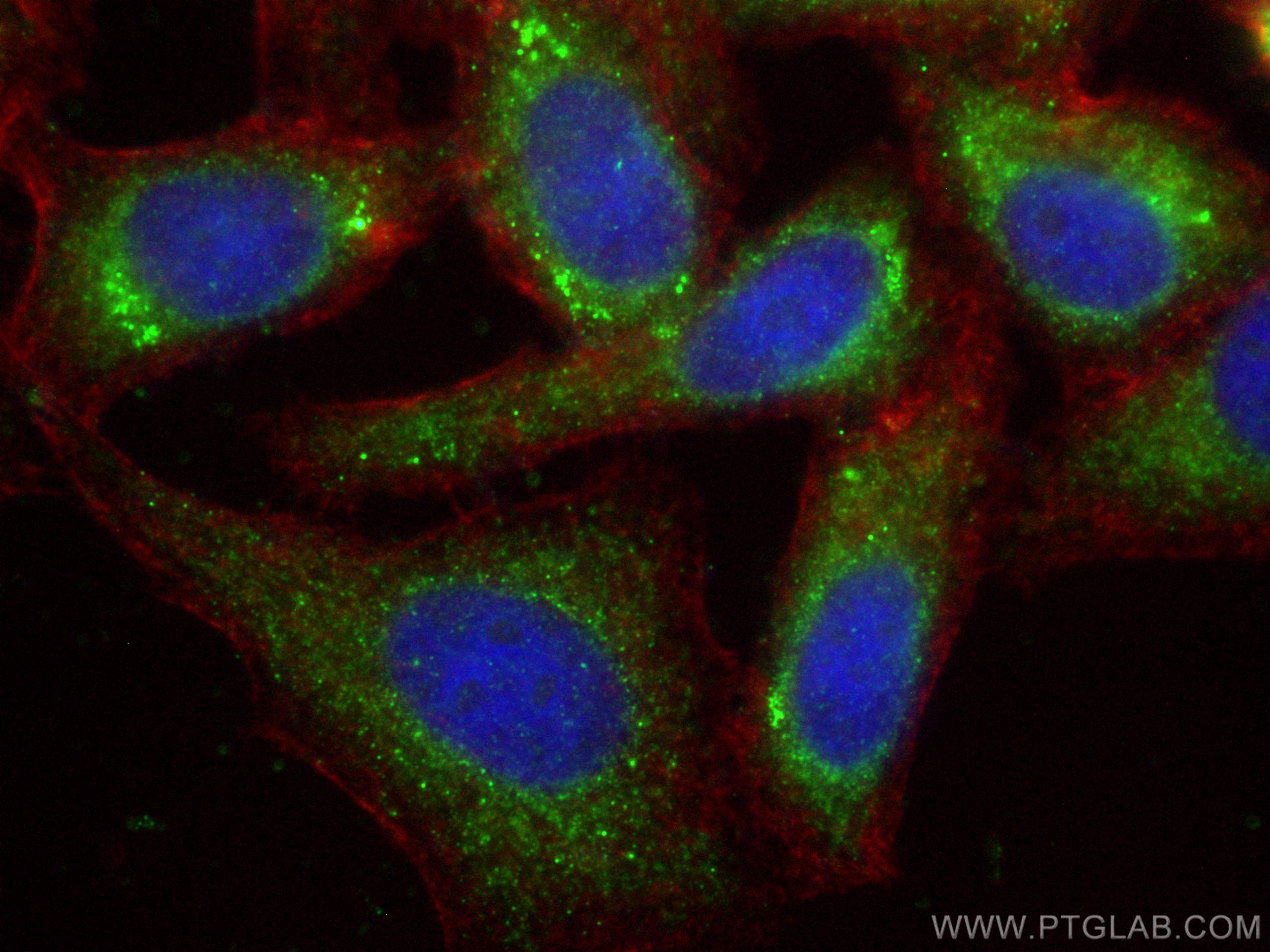 IF Staining of HepG2 using 31079-1-AP