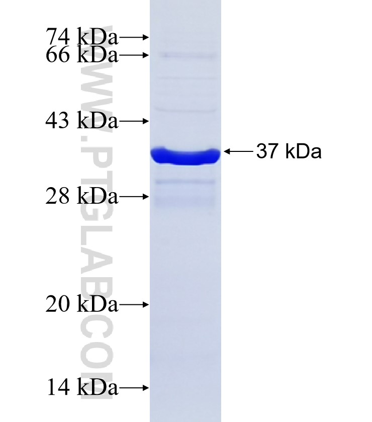 DNAH5 fusion protein Ag34647 SDS-PAGE