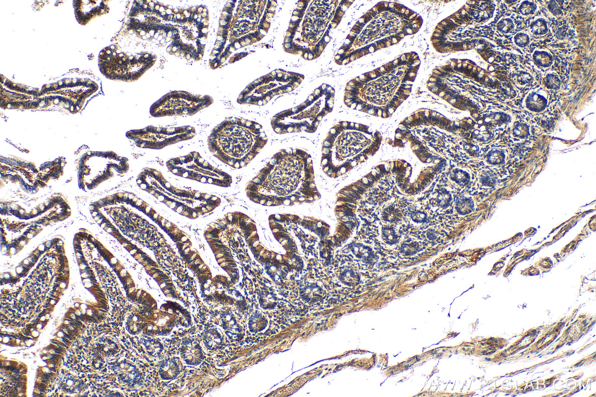 IHC staining of human small intestine using 18080-1-AP