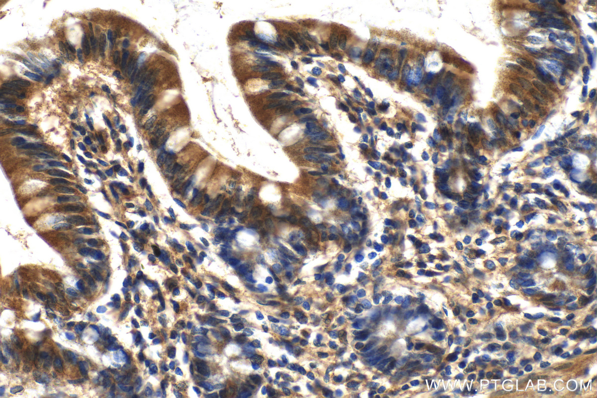 IHC staining of human small intestine using 18080-1-AP