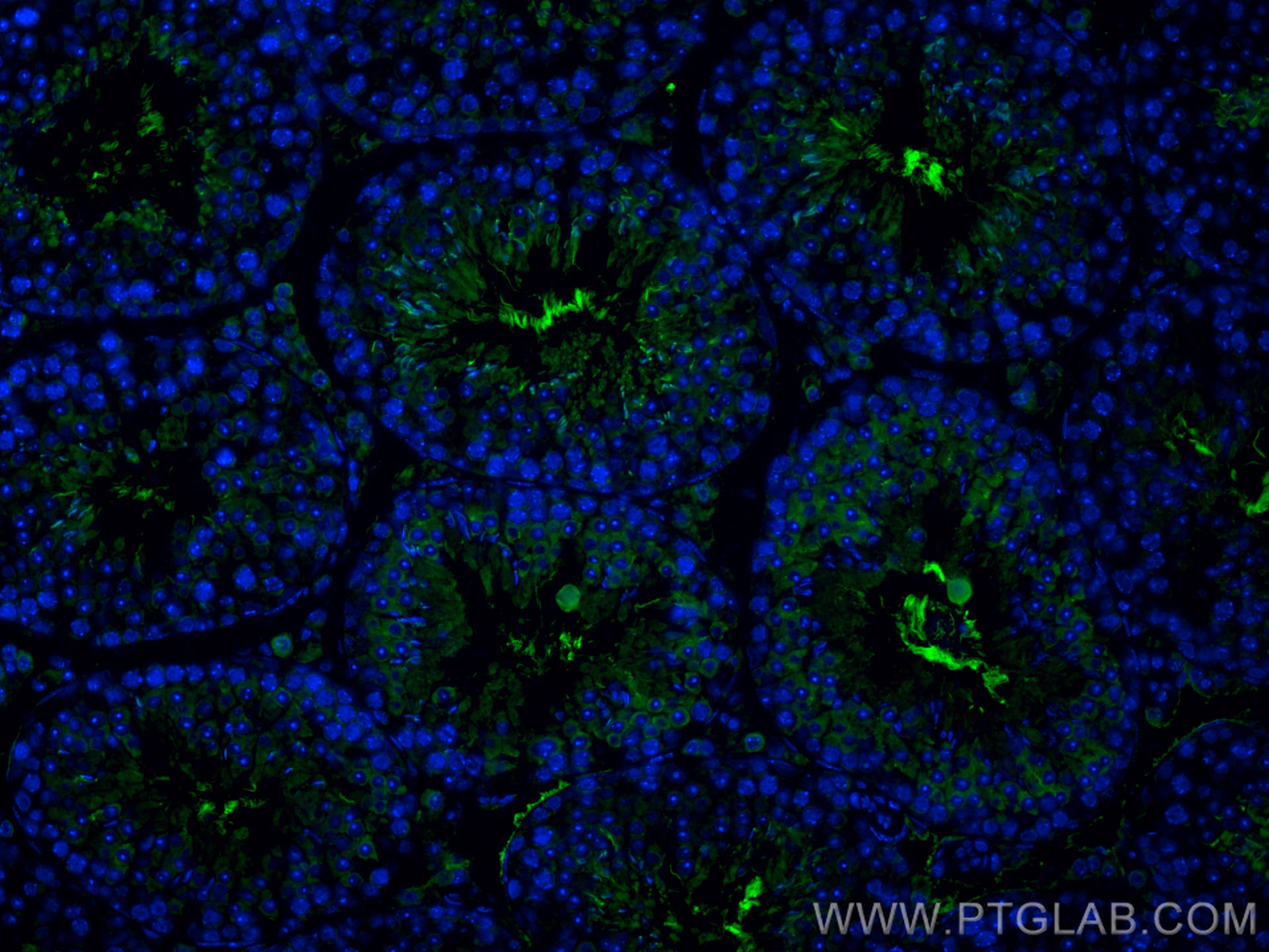 IF Staining of mouse testis using 17533-1-AP