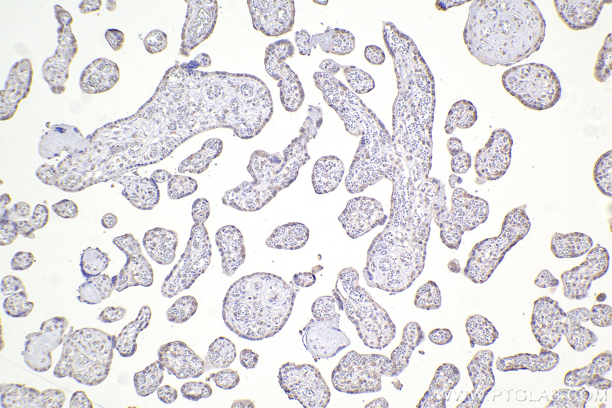 IHC staining of human placenta using 67184-1-Ig