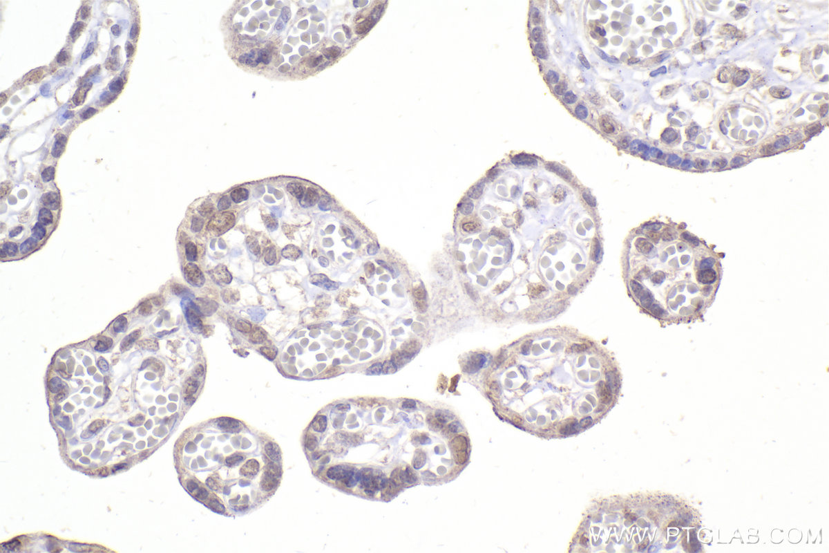 IHC staining of human placenta using 67184-1-Ig