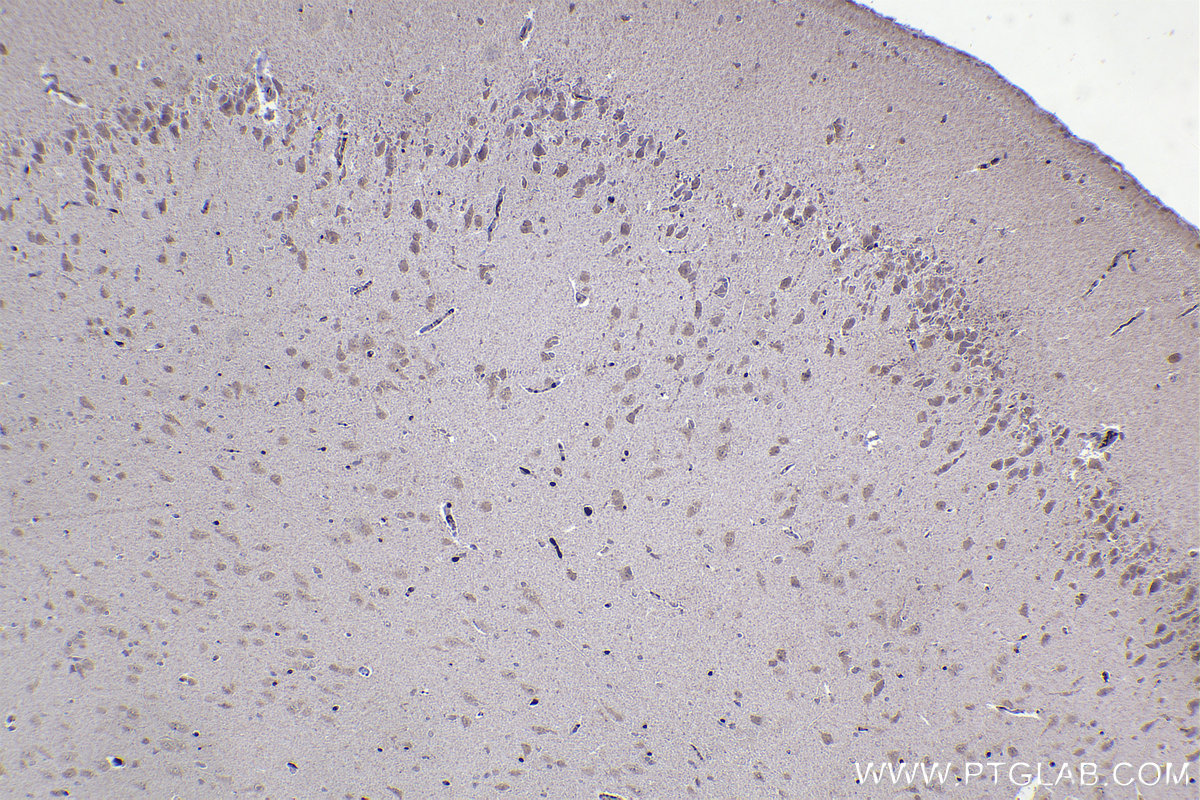 IHC staining of rat brain using 67184-1-Ig