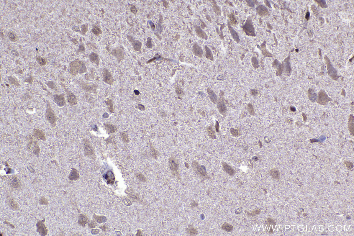 IHC staining of rat brain using 67184-1-Ig