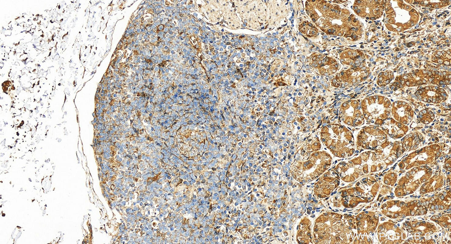 IHC staining of human stomach using 16780-1-AP