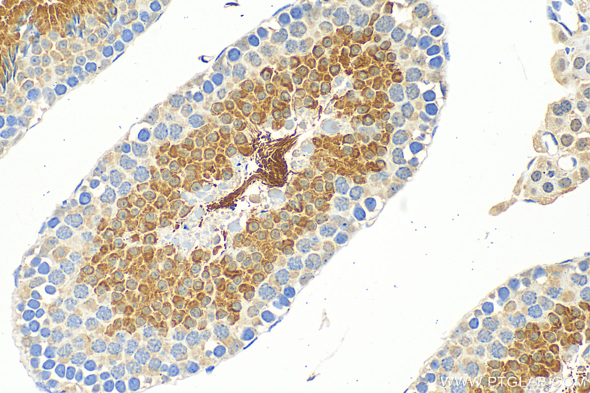 IHC staining of mouse testis using 25118-1-AP