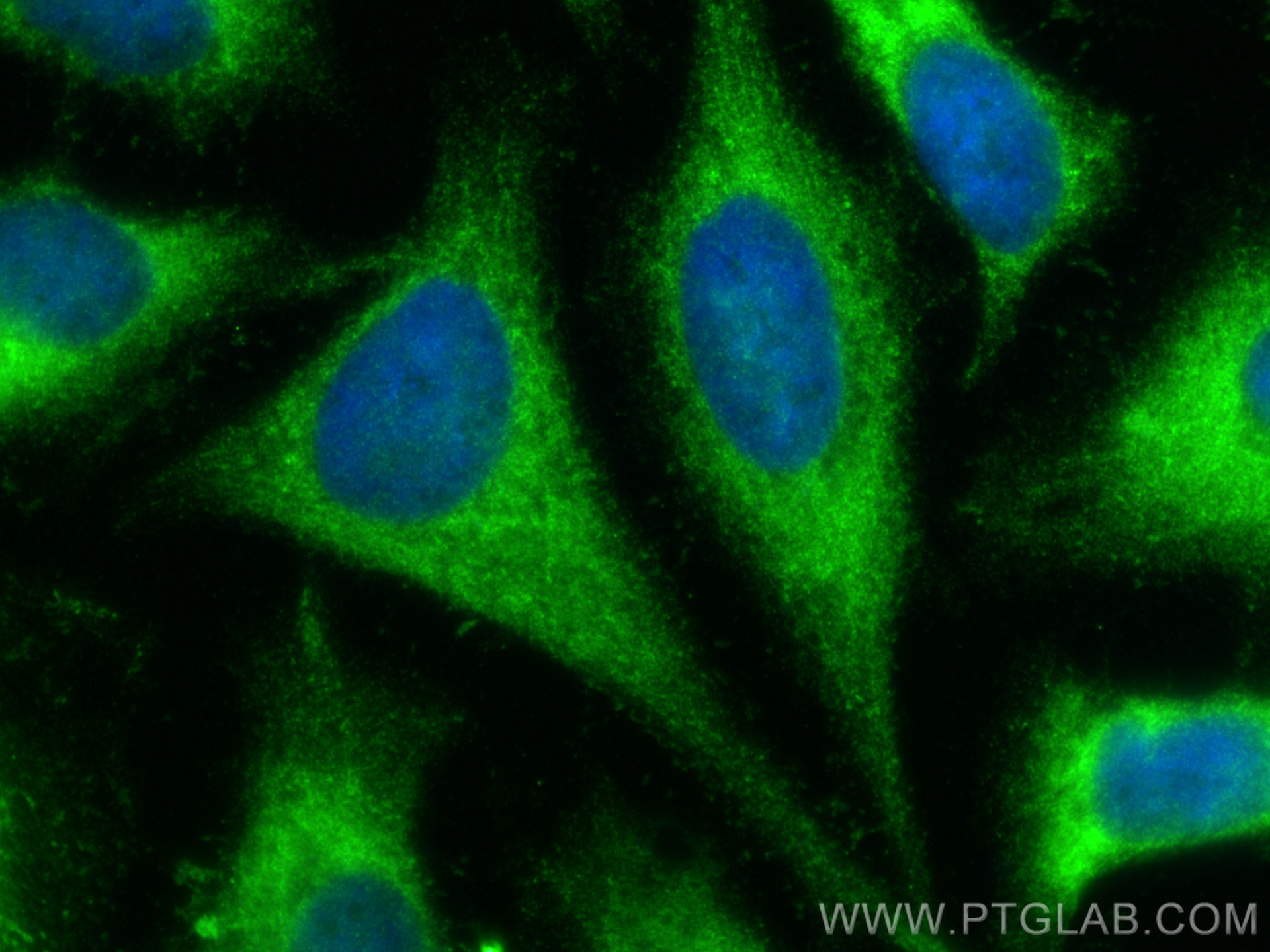 IF Staining of HeLa using 16501-1-AP