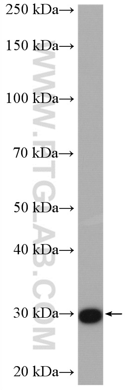 WB analysis of mouse testis using 17177-1-AP