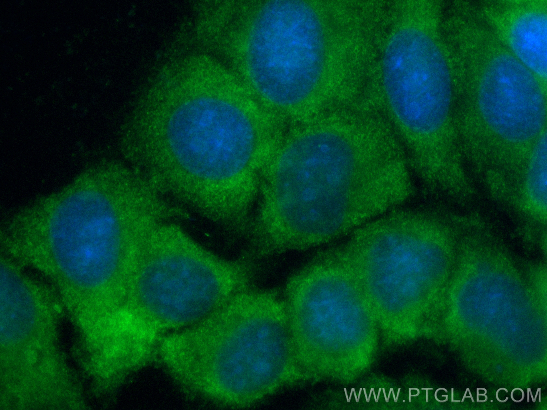 IF Staining of MCF-7 using CL488-13064