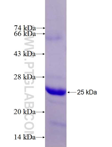 DNAJB9 fusion protein Ag27432 SDS-PAGE