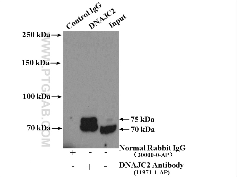 IP experiment of mouse liver using 11971-1-AP