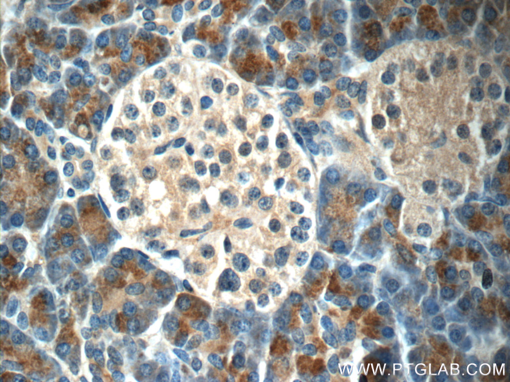 IHC staining of human pancreas using 23411-1-AP