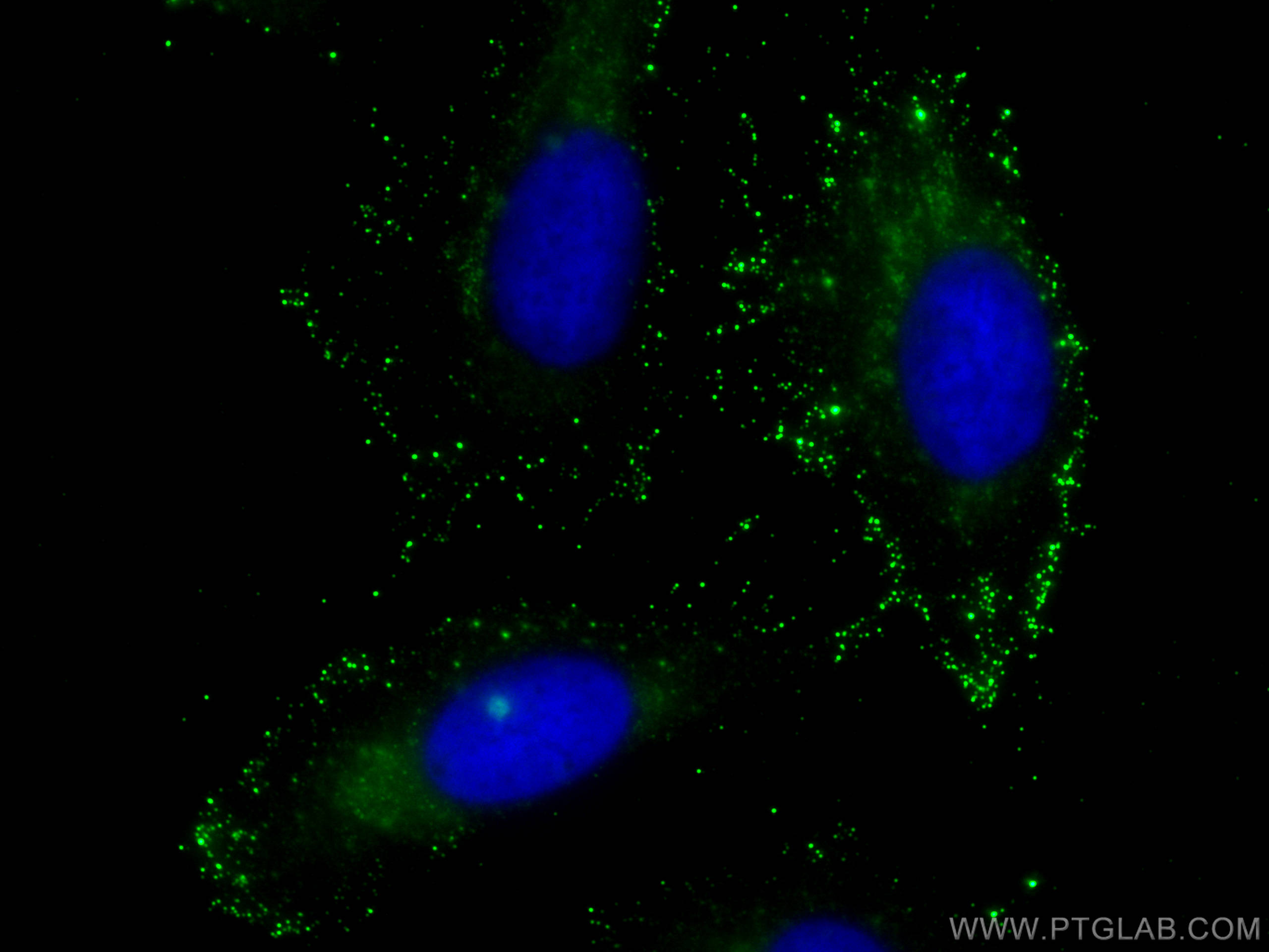 IF Staining of U2OS using 68343-1-Ig (same clone as 68343-1-PBS)