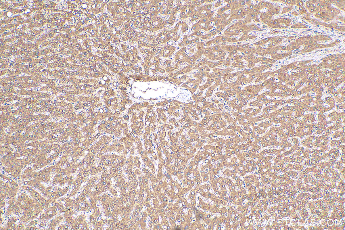 IHC staining of human liver using 26229-1-AP