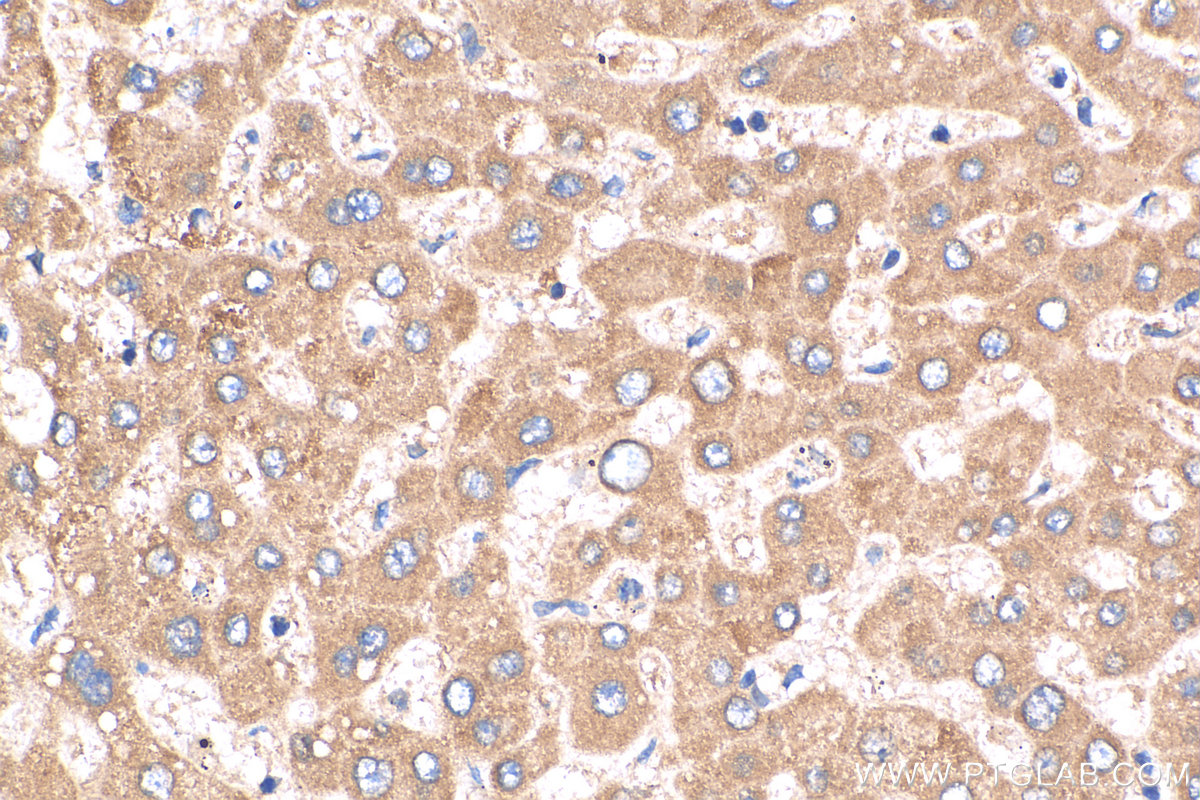 IHC staining of human liver using 26229-1-AP