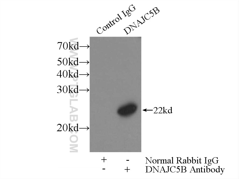 IP experiment of mouse testis using 17364-1-AP