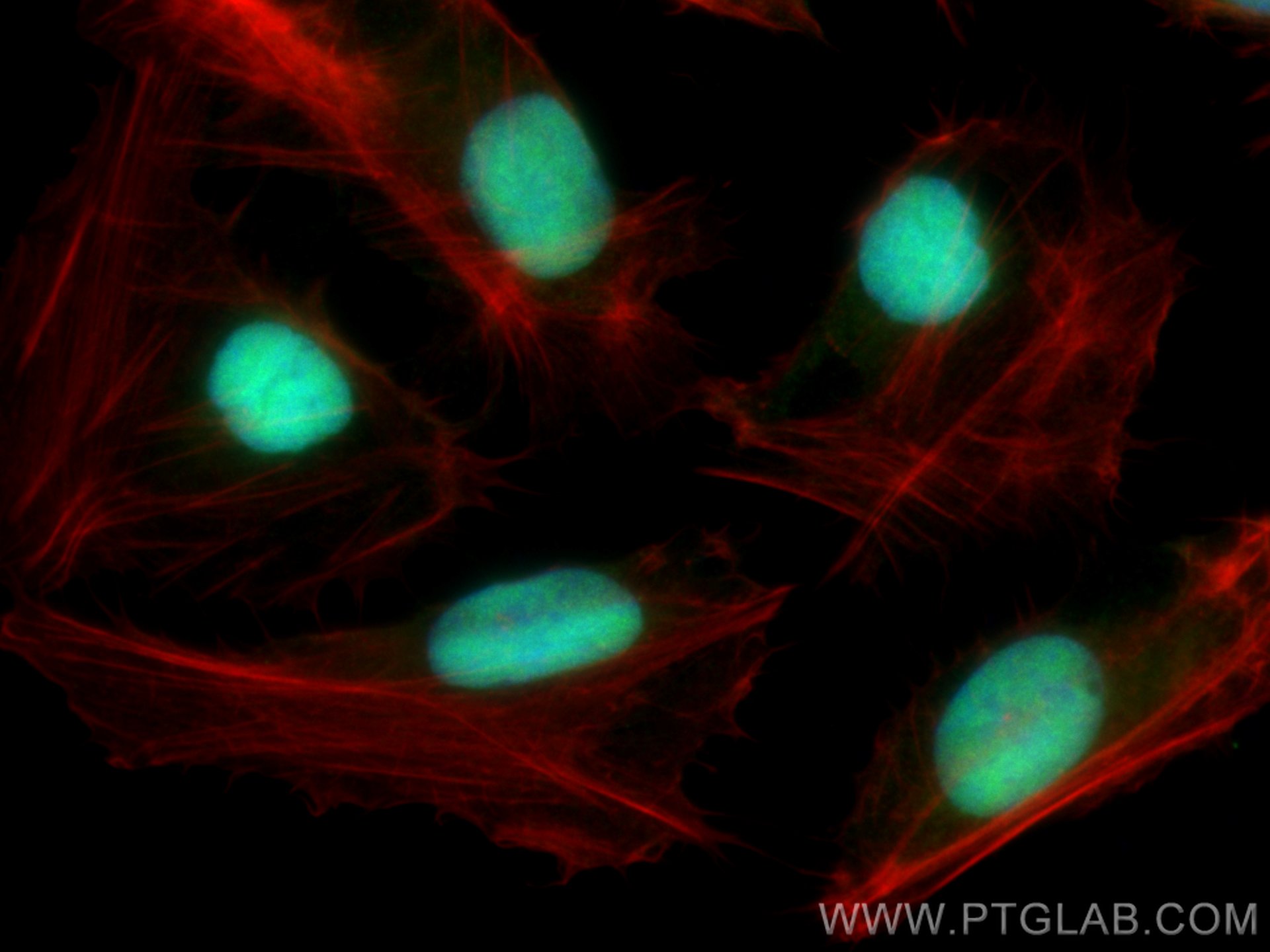 IF Staining of U2OS using 25444-1-AP