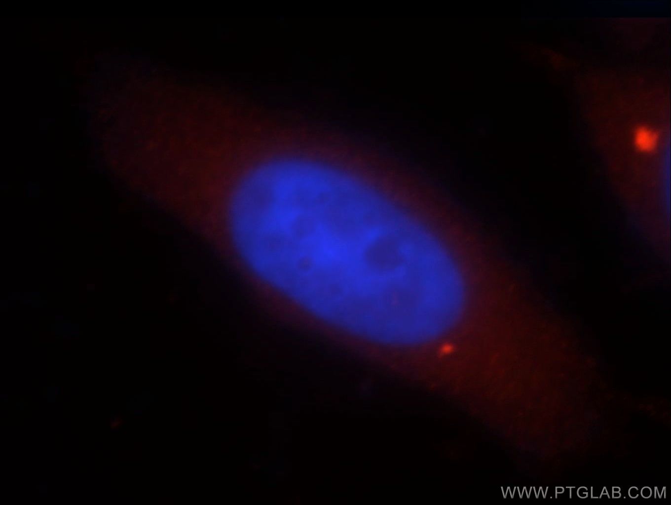 IF Staining of MCF-7 using 13653-1-AP