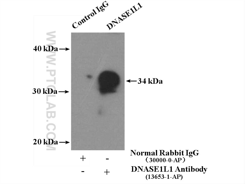 IP experiment of mouse skeletal muscle using 13653-1-AP