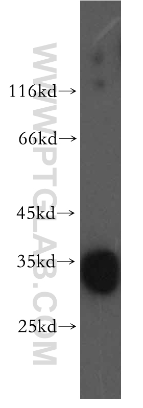 WB analysis of mouse skeletal muscle using 13653-1-AP