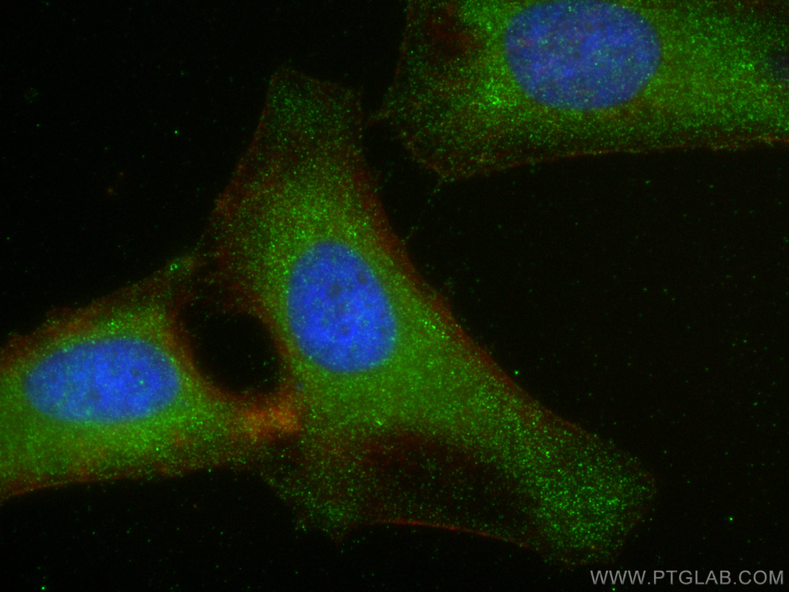 IF Staining of HeLa using 15934-1-AP