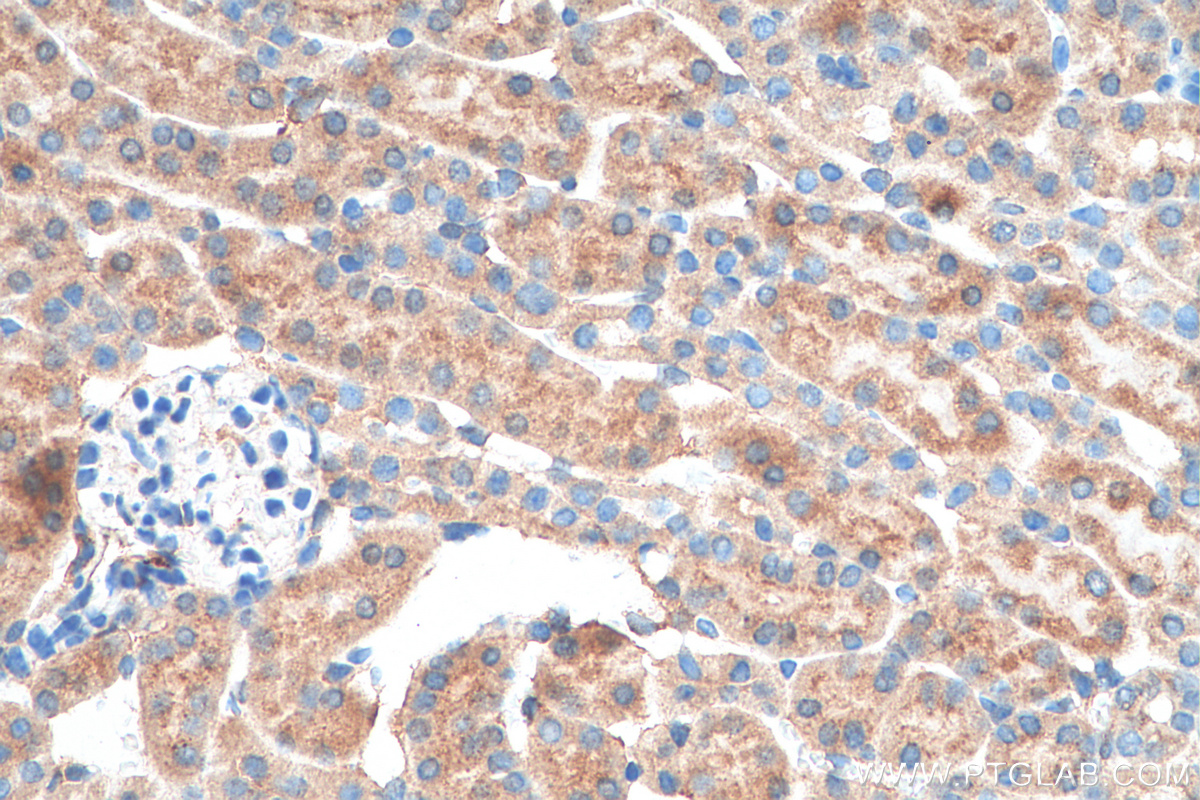 IHC staining of mouse kidney using 15934-1-AP