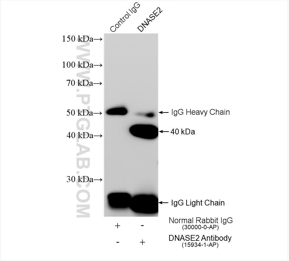 IP experiment of HeLa using 15934-1-AP