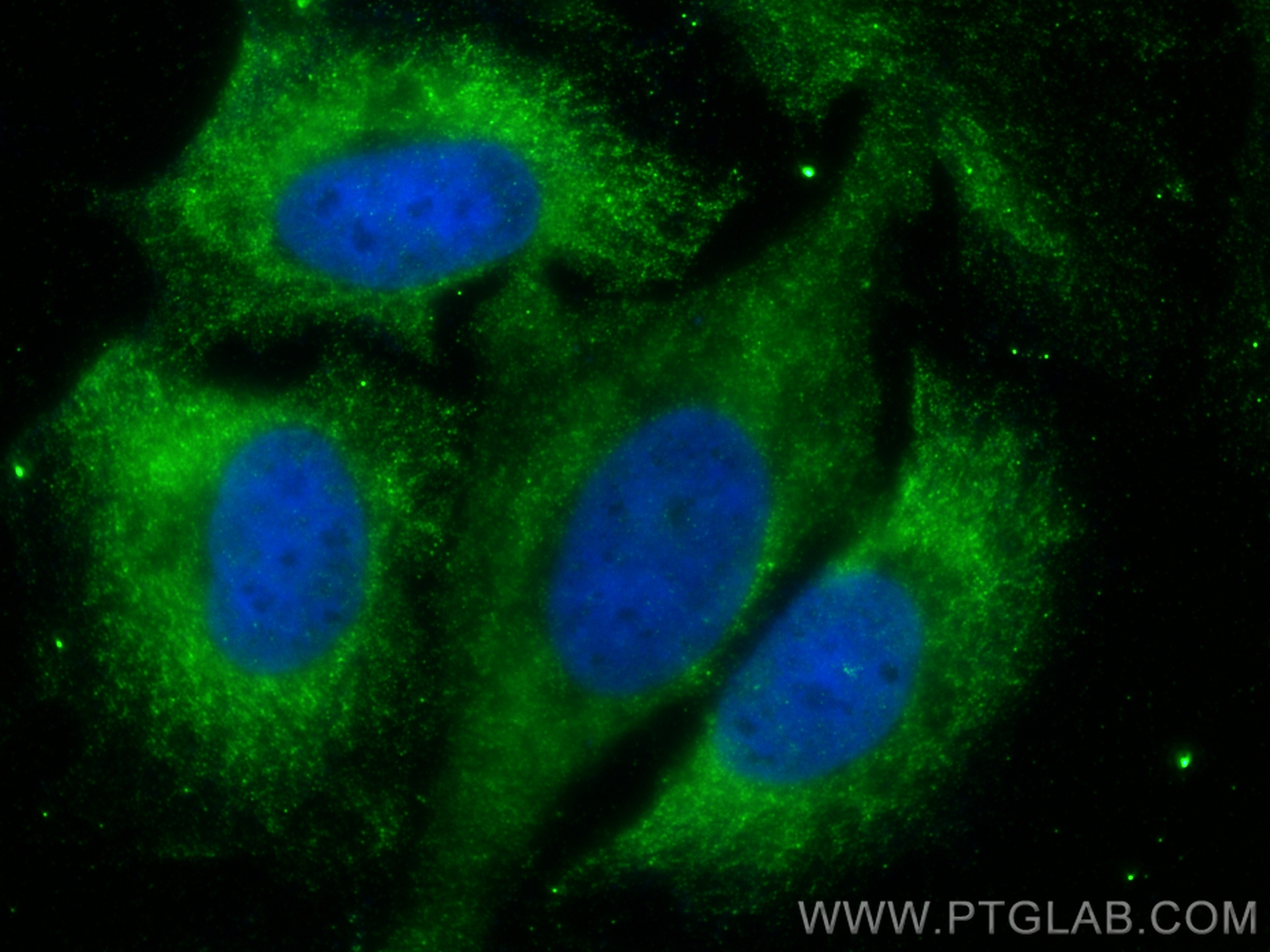 IF Staining of HeLa using 26187-1-AP