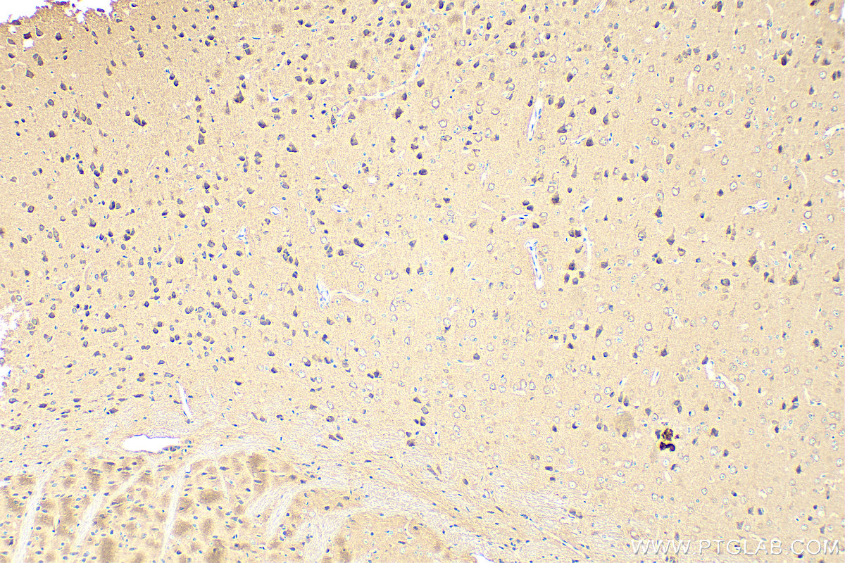 IHC staining of mouse brain using 14737-1-AP