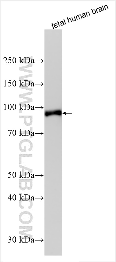 WB analysis using 14737-1-AP