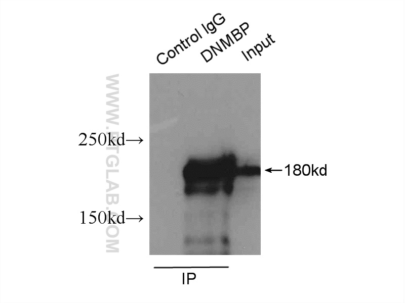 IP experiment of mouse testis using 17191-1-AP