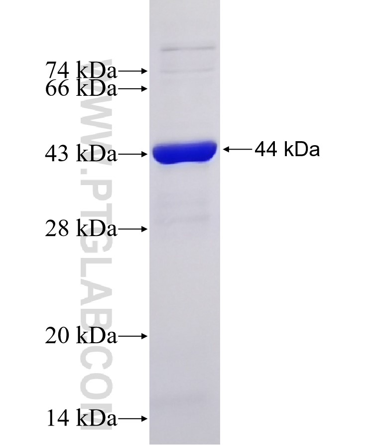 DNMT1 fusion protein Ag29479 SDS-PAGE