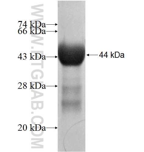 DNMT3A fusion protein Ag7015 SDS-PAGE