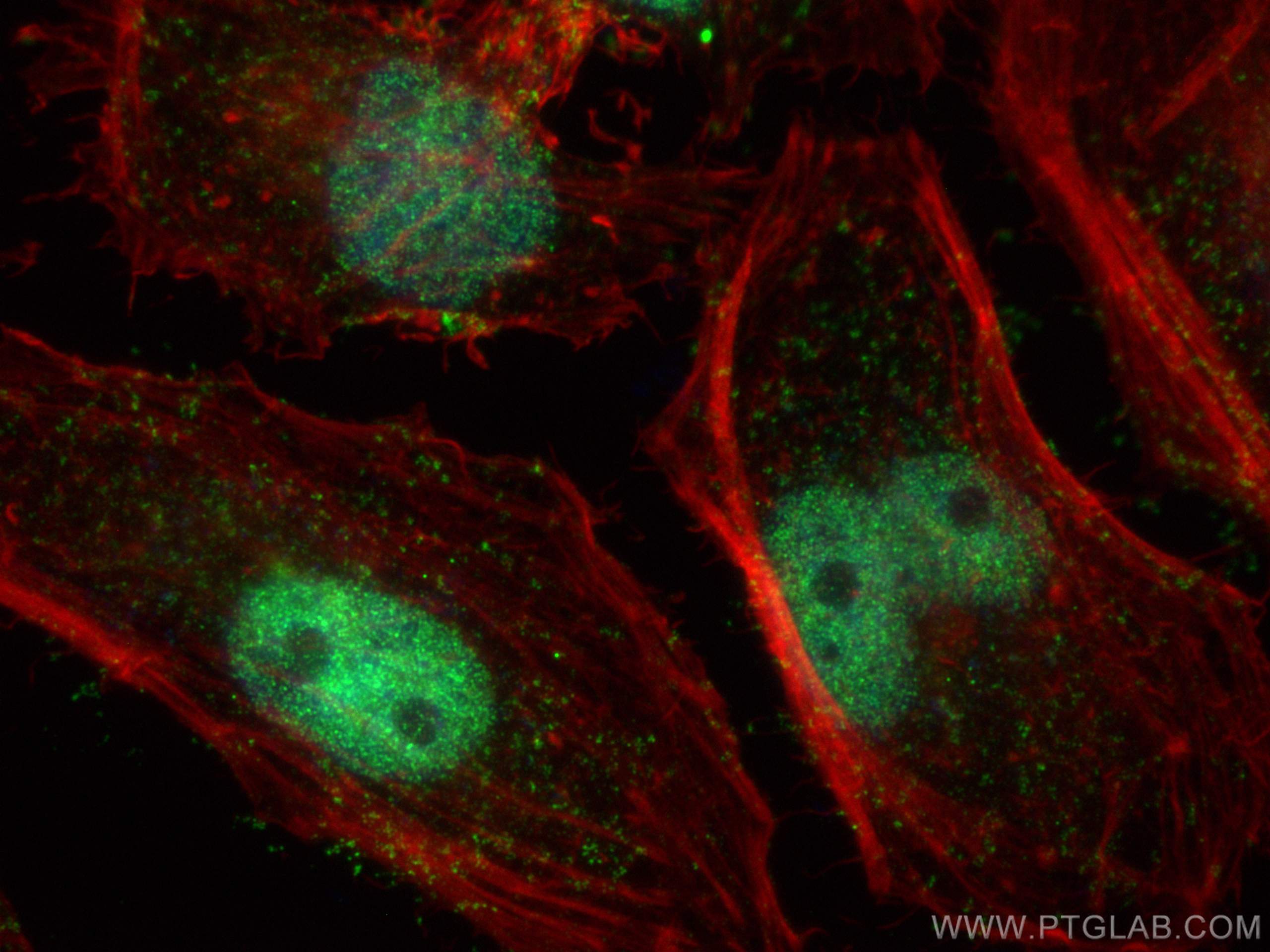 IF Staining of HeLa using 11637-1-AP