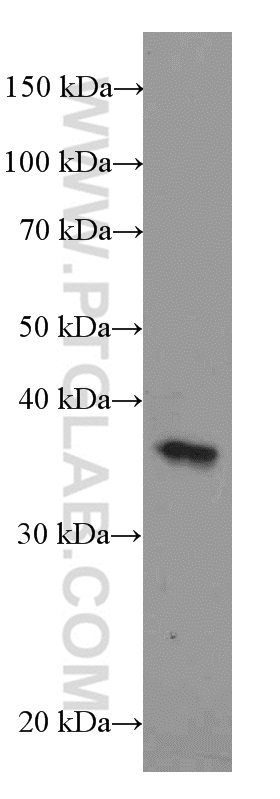 WB analysis of HeLa cells using 11637-1-AP