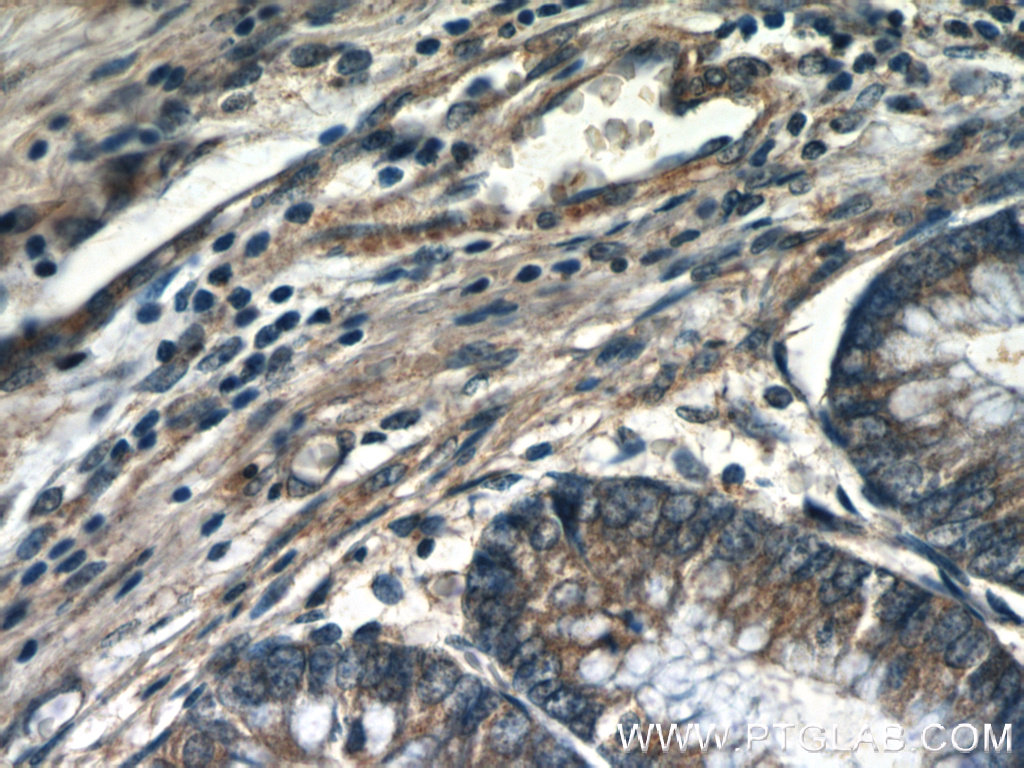 IHC staining of human colon using 23421-1-AP