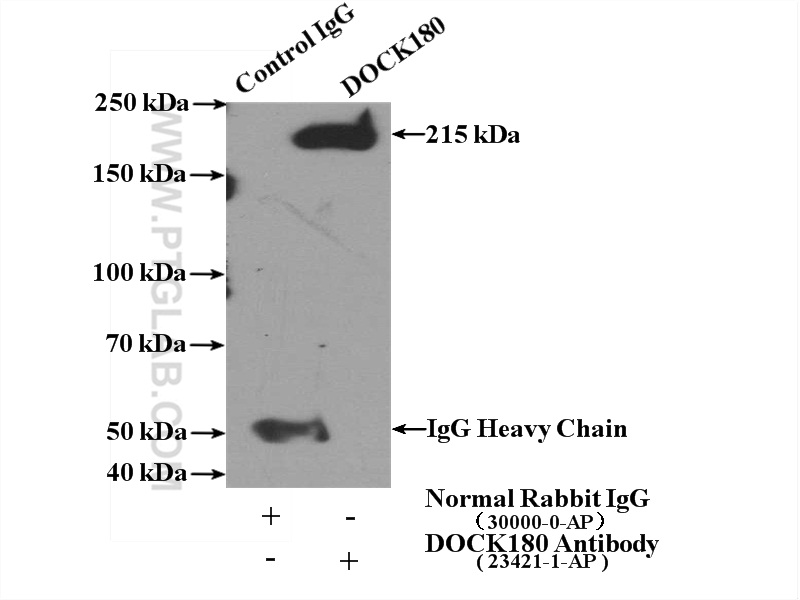 IP experiment of HeLa using 23421-1-AP