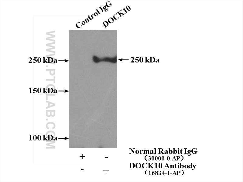 IP experiment of HeLa using 16834-1-AP