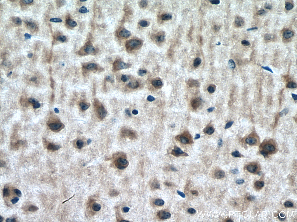 IHC staining of mouse brain using 20683-1-AP