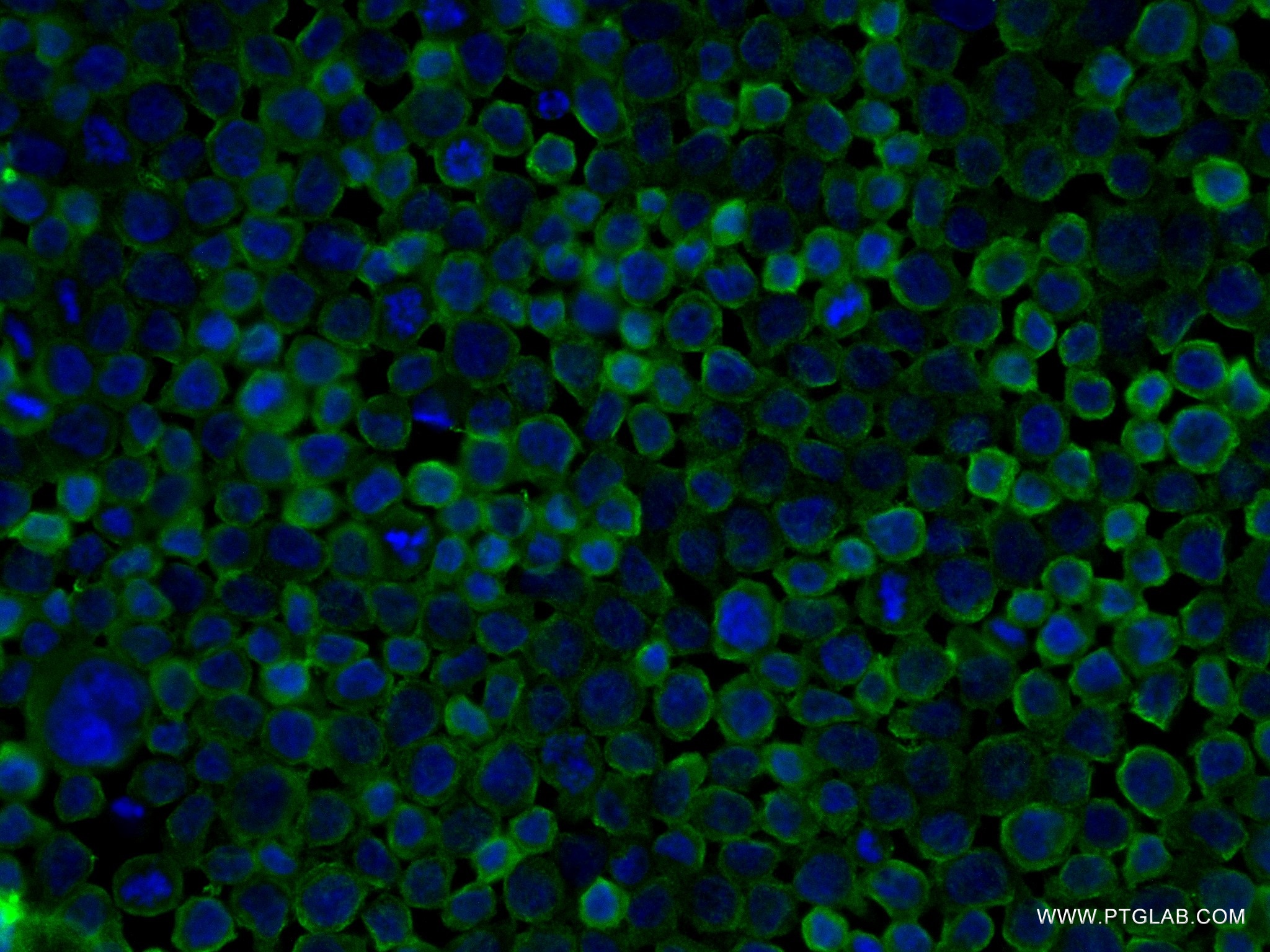 IF Staining of THP-1 using 83270-2-RR (same clone as 83270-2-PBS)