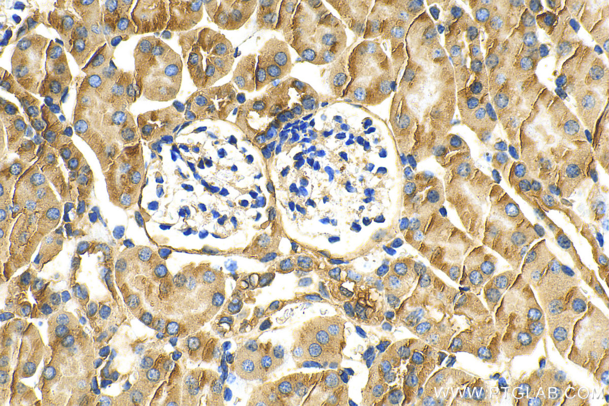 IHC staining of mouse kidney using 83270-2-RR